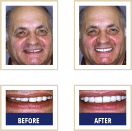 Blog Carlsbad - Before After 01