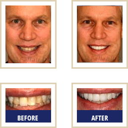 Blog Carlsbad - Before After 02