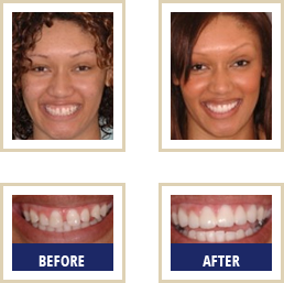 Blog Carlsbad - Before After 03