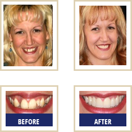 Blog Carlsbad - Before After 04