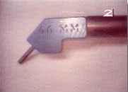 No Drilling Fillings Willoughby Hills - No Drilling Fillings