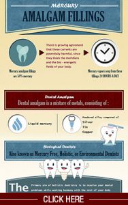 Amalgam Fillign Infographic