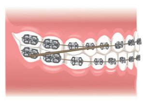 Orthodontics