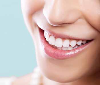 Smilling lady with showing her brighter teeth