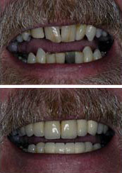 Smile Gallery Sacramento - Gallery Photo 10