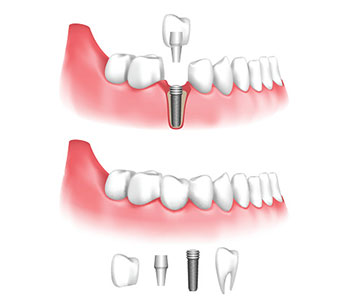 Recommended Oral Surgeon Tyrone, GA