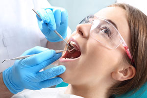 wisdom-teeth