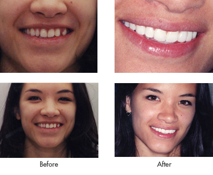 Claire - Before and After