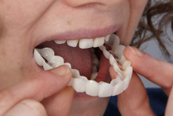 Snap on Smiles Chicago - Using