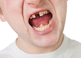 Broken Tooth Chicago - Broken Tooth of Men