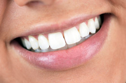Whitening your Teeth Chicago - Smiling Woman