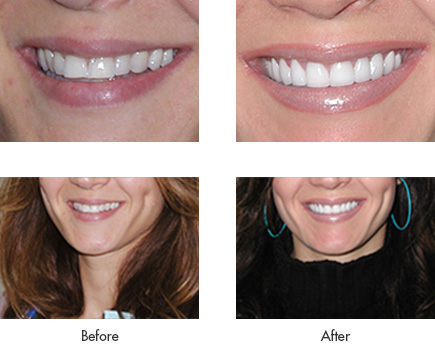 Julie - Before and After
