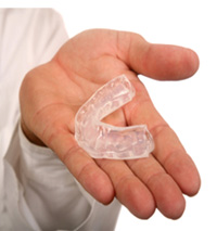 Mouth Guards Chicago - Mouth Guards