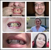 Dental News Chicago - Rock my smile contest