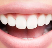 Teeth Whitening in Chicago IL - Beautiful woman Smile