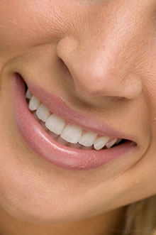 Benefits Of Veneers In Chicago -  Woman smiling
