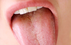 Bad Breath Chicago - Mouth