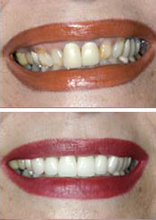 Smile Gallery Sacramento - Gallery Photo 11