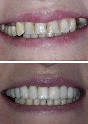 Smile Gallery Sacramento - Gallery Photo 14