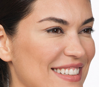 Before Botox Treatment, Case 04