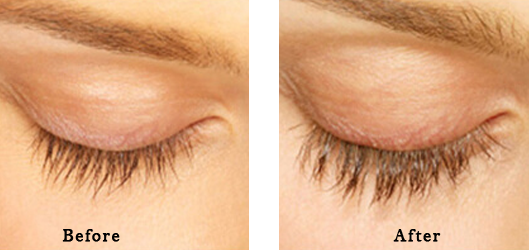 Before After Images-2