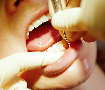 Endodontic surgery, or root canal treatment, available to Scarborough ON area patients