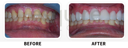 Cosmetic Makeover Image 02