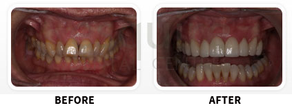 Cosmetic Makeover Image 05