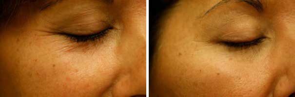 Products Franklin - SkinMedica Before and After