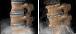 Health Risk Assessment Portland - Face joints image