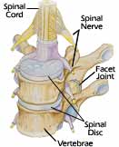 Health Risk Assessment Portland - Facet Joints