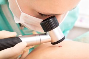 Skin Cancer Examination