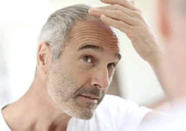 Hair Loss