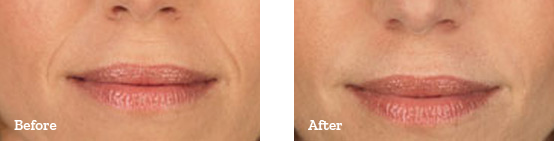 Before After image 04