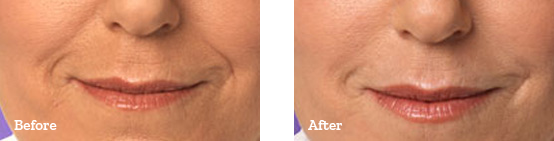 Before After image 05