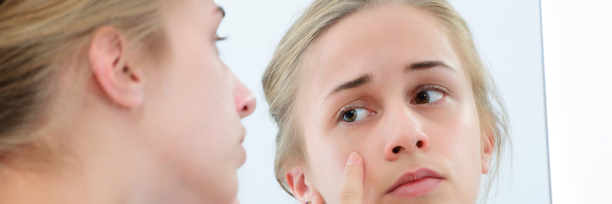 McKinney, TX area residents ask, “How are pimple scars formed, and what is the best method of treatment for them?”