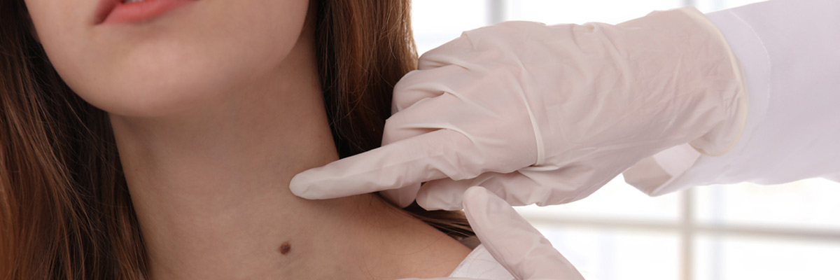 Plano residents discover how to remove facial brown spots proven, non-surgical treatments