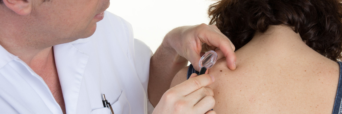 Plano patients with skin cancer can access the gold standard treatment: Mohs surgery