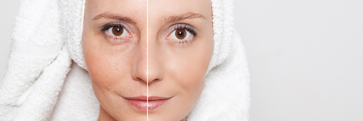 McKinney, TX residents enjoy benefits of laser skin tightening treatments