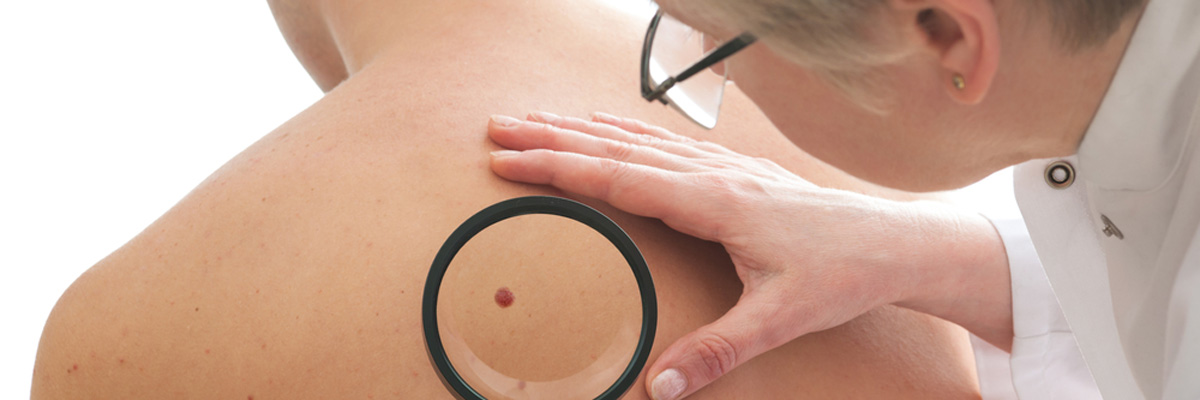 Flower Mound, TX area patients ask, “What is Mohs skin cancer surgery?”