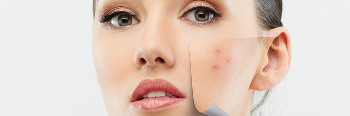 Dermatologist in Flower Mound, TX describes options available for treatment of rosacea
