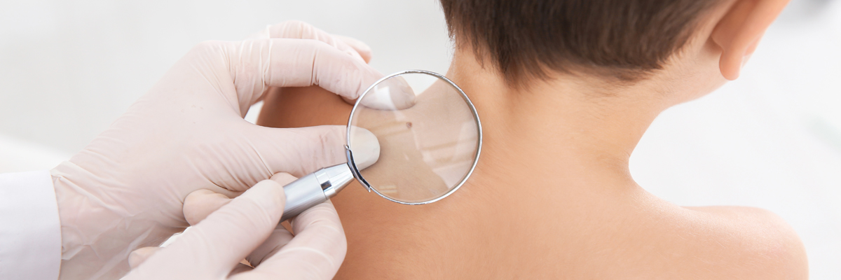 Dermatologist examining little boy's birthmark
