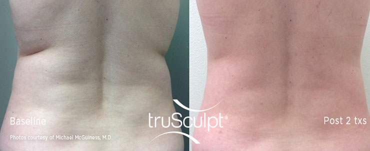 Dr. Dennis Dass, NtruSculpt iD image 5