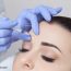 How to look relaxed and refreshed in Beverly Hills CA with Botox Injections