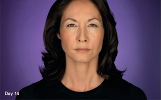 <?php echo $pk; ?> - Botox Image 4