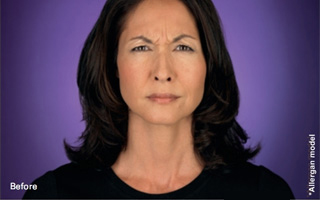 <?php echo $pk; ?> - Botox Image 3