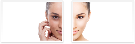 Dermatologist  Downey - Before and after 04
