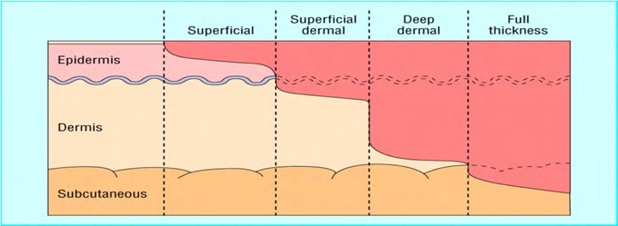 Intracell