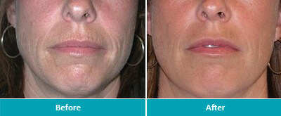 Dr. Jeanine Downie Montclair - Before and After 3