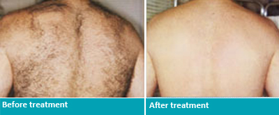 Dr. Jeanine Downie Montclair - Before and After 2